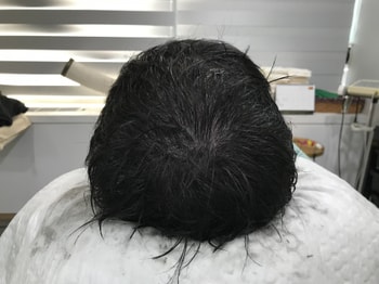 리터치 후 젖은 상태입니다