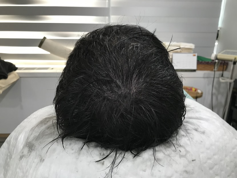 리터치 후 젖은 상태입니다
