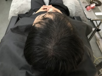 시술 후