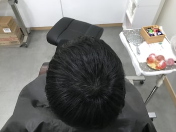 &lt;시술 후&gt;