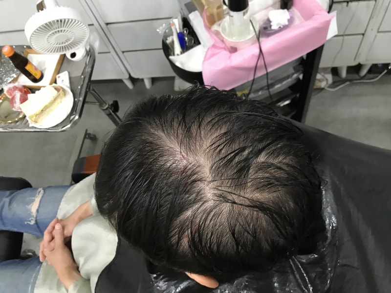 Gradient Dot scalp tattoo review