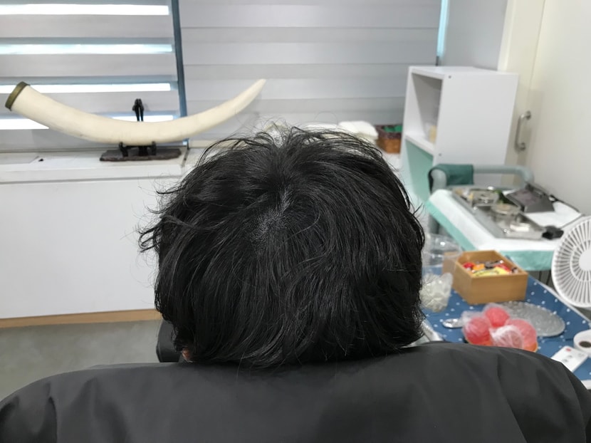 2차 리터치 후