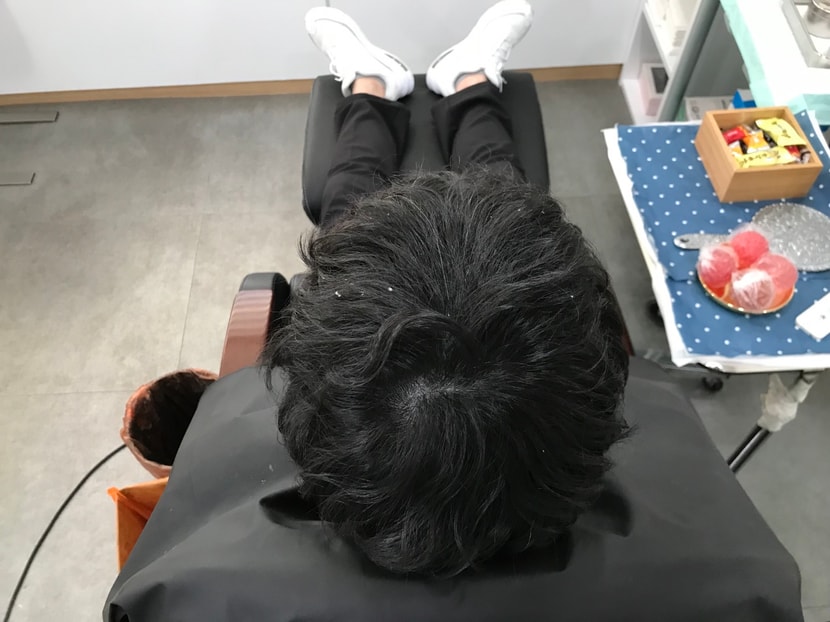 2차 리터치 전 (각질 때문에 양해 부탁드려요 ㅠ)