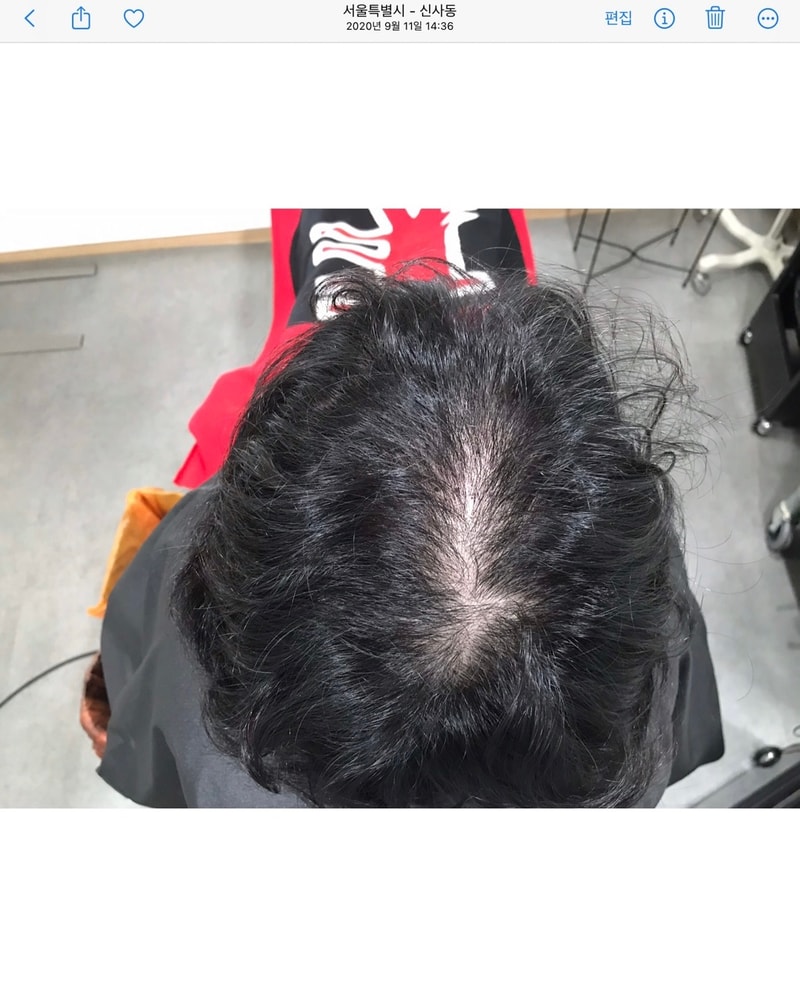 The scalp tattoo is Yonsei-mi-dine.