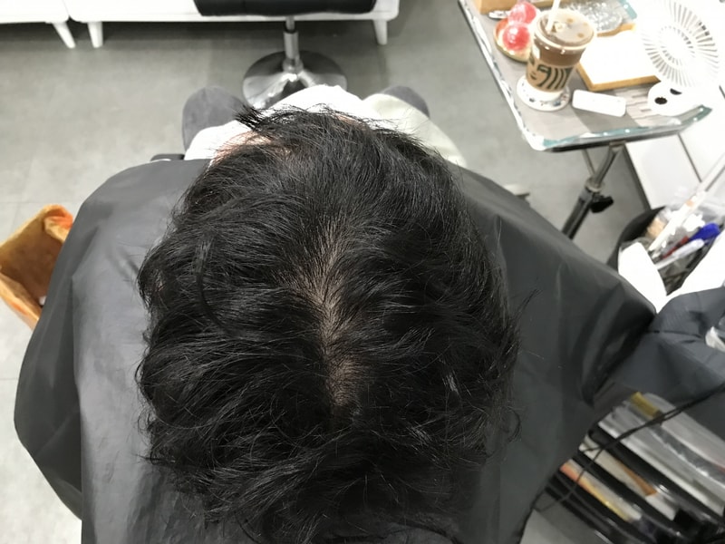 在延世美达人接受了第一次手术