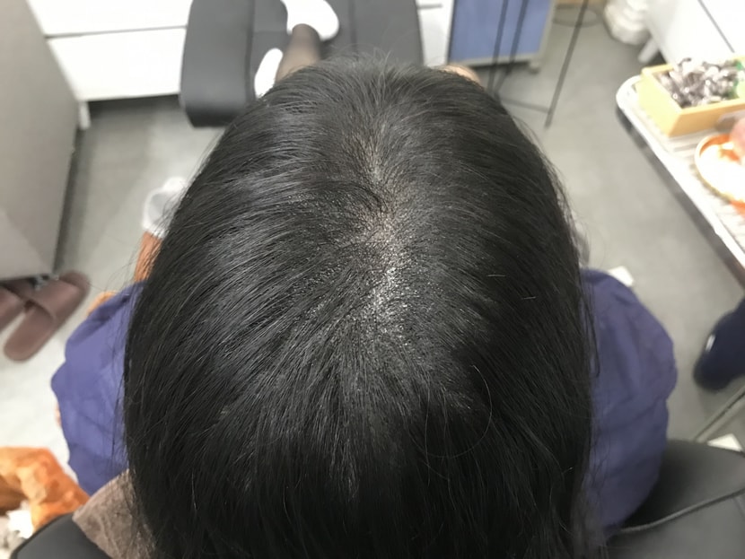 2차 리터치까지 완료
