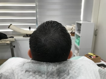 시술후 젖은머리