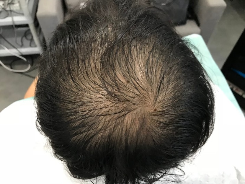 아예문신전
