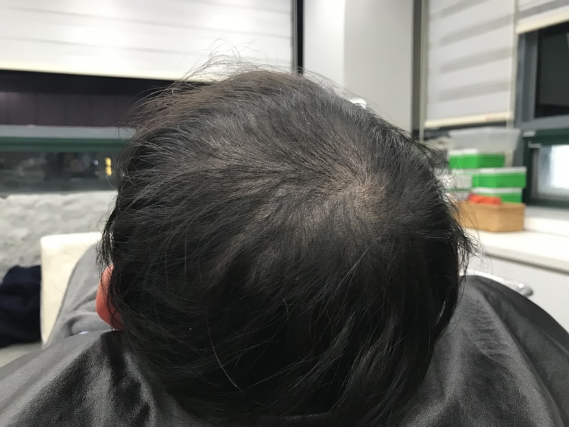 보강전