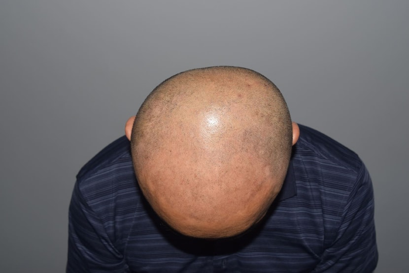 하고나서