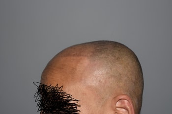 하고나서
