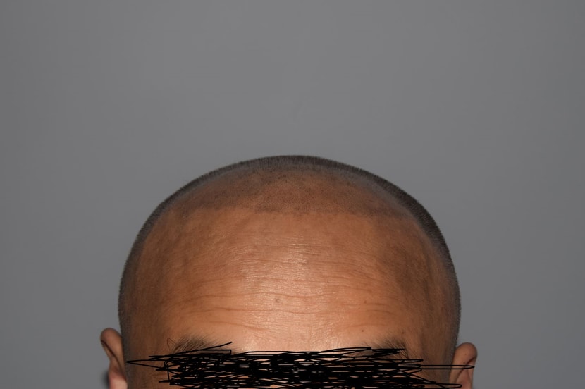 하고나서