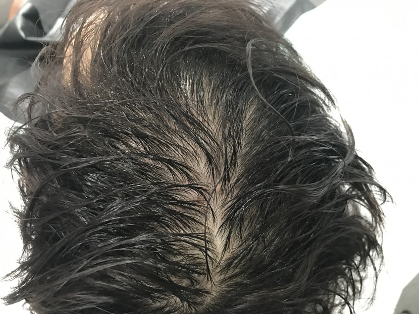 시술 전 젖은상태1