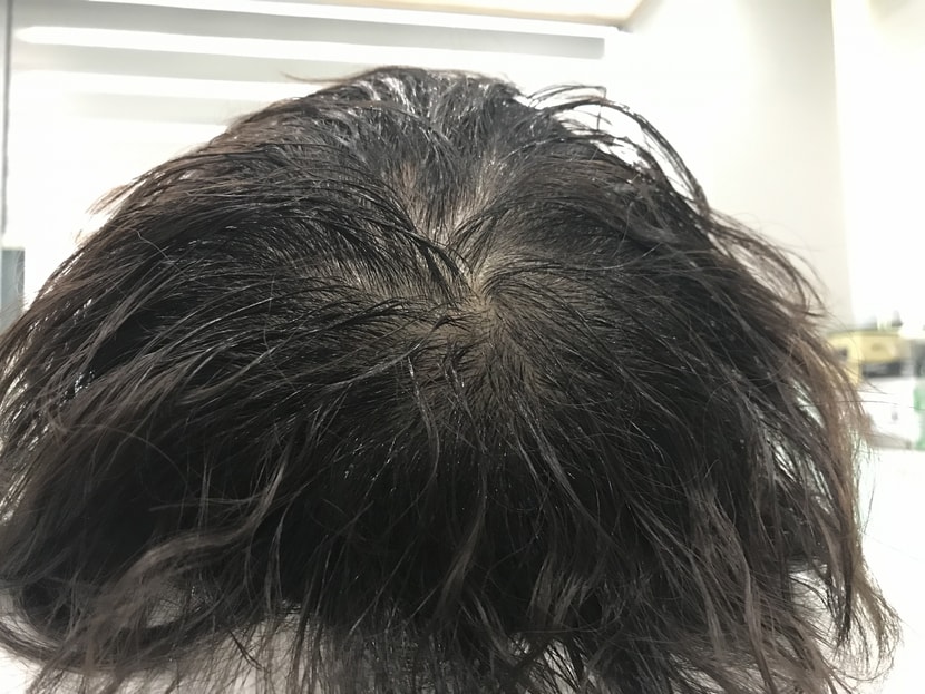 시술전 젖은상태 2