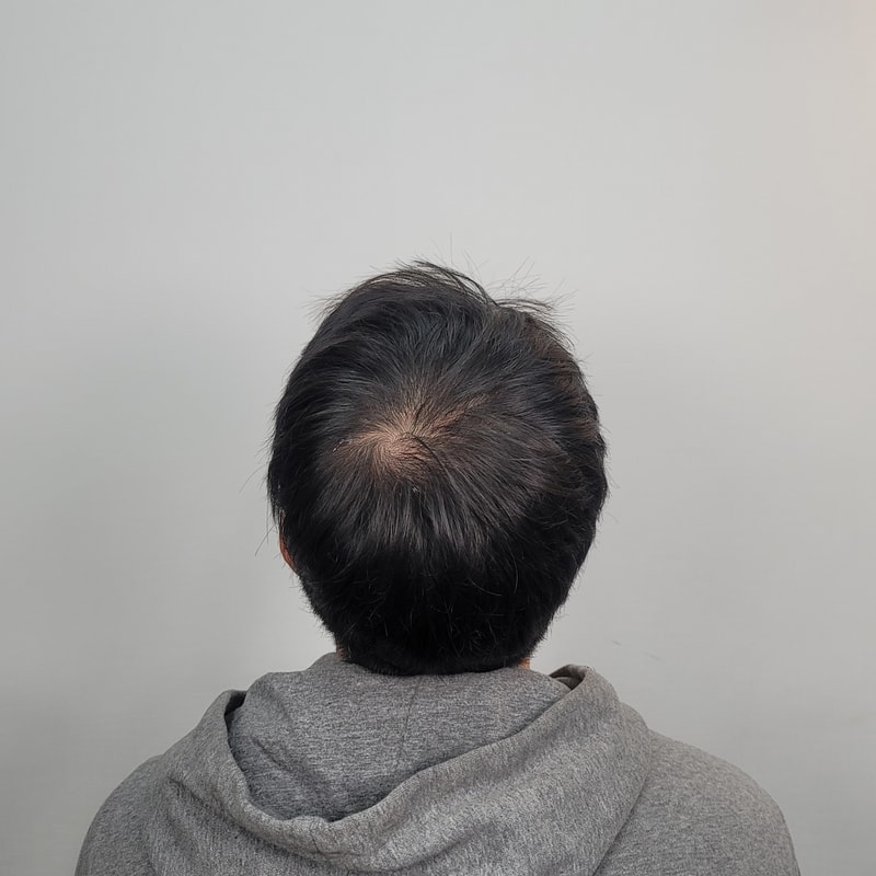 頭皮タトゥー体験談！