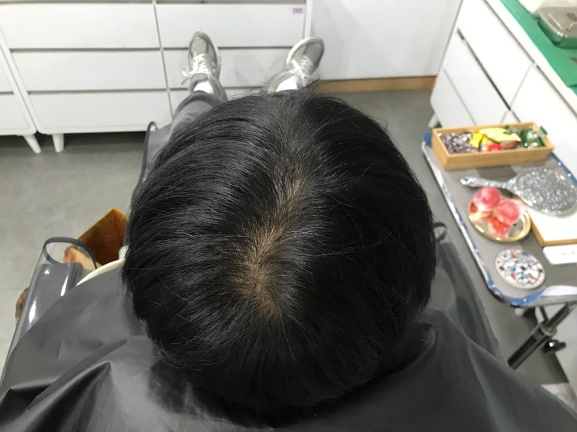문신 전2