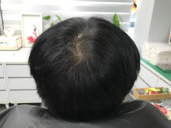 문신 전