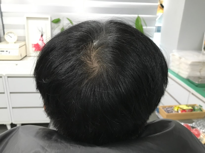 문신 전