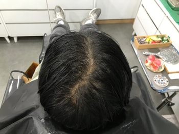 문신 전3