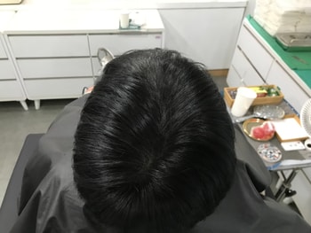 문신 후