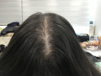 전