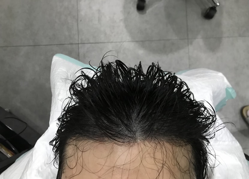 리터치후 사진입니다 (밀도가 더욱더  좋아졌습니다)