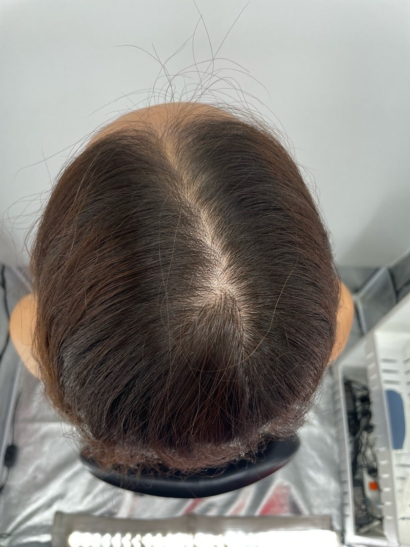 강남뉴헤어에서 두피문신 만족해요!