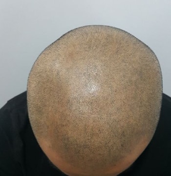 1차리터치