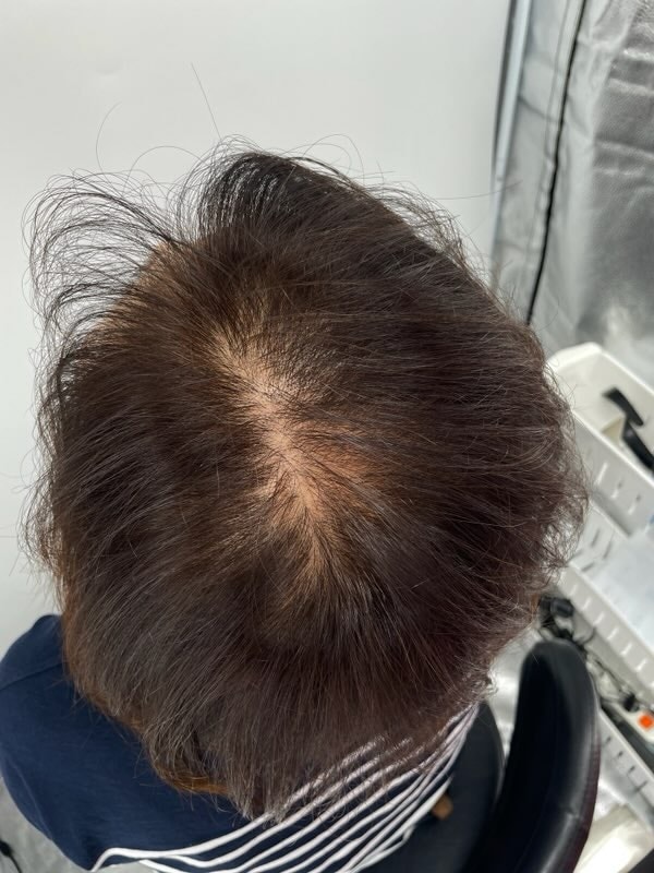 강남 헤어타투 두피문신 뉴헤어에서 하세요 ^^ 여기 찐