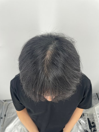 가르마 문신 전