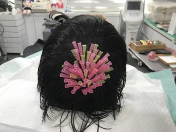 모발 볼륨 리프팅 사진