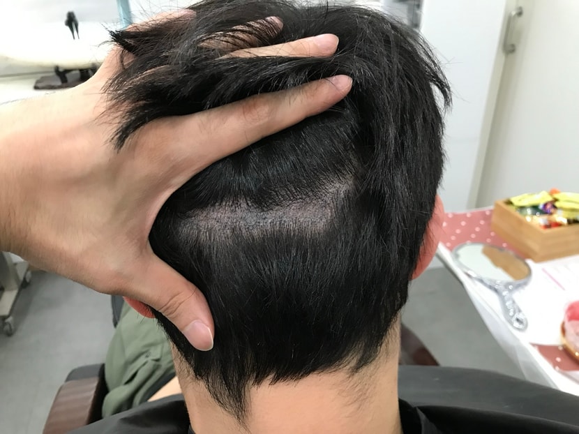 보강 전