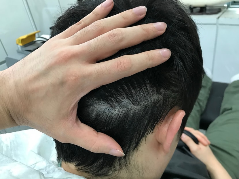 보강 후