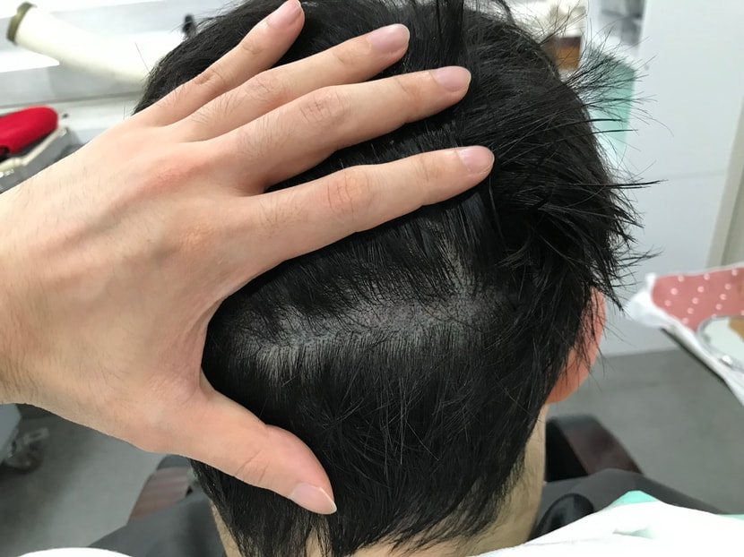 보강 후