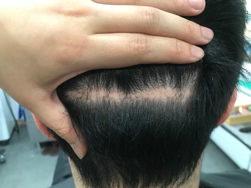 It's the first review of scalp tattoos