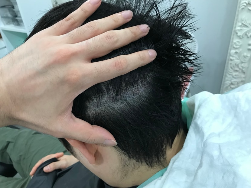 보강 후