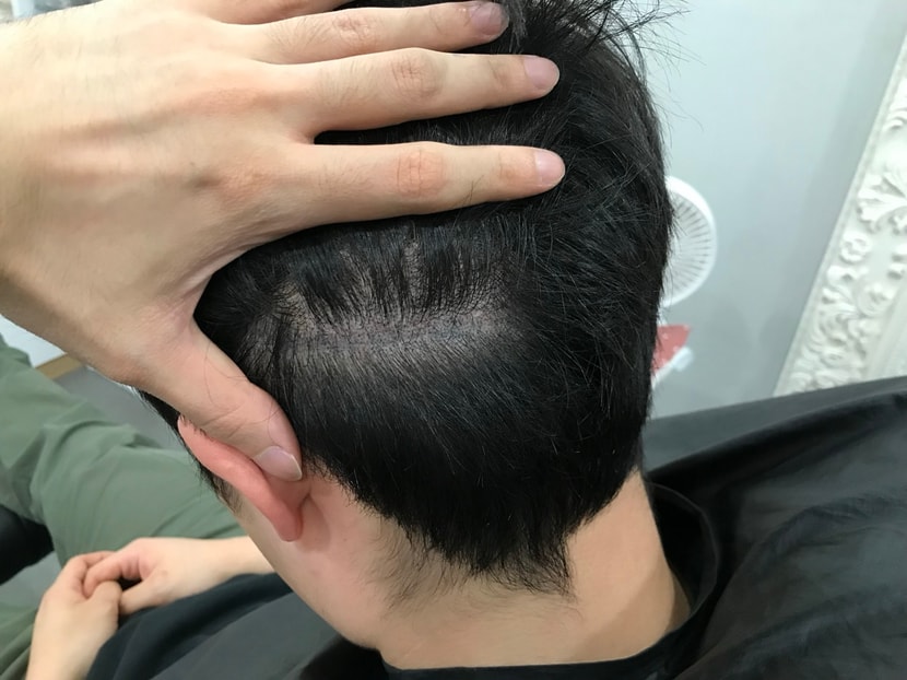 보강 전