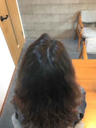 후