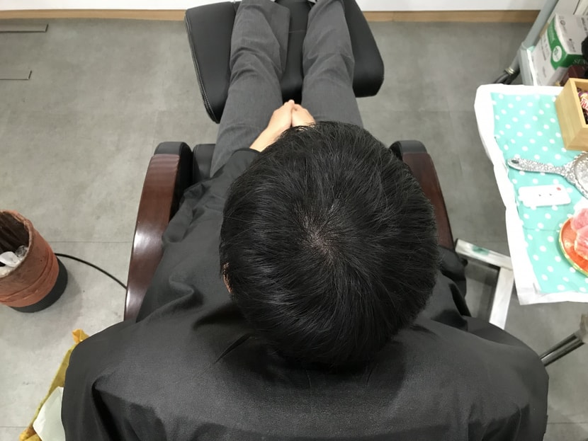 시술 후