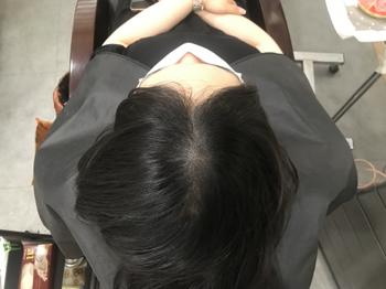 보강 전