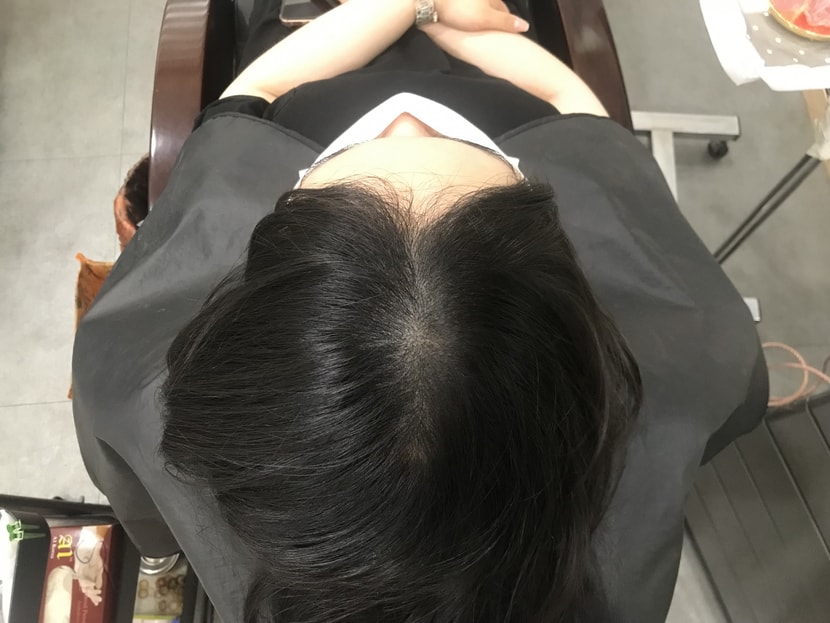 보강 전