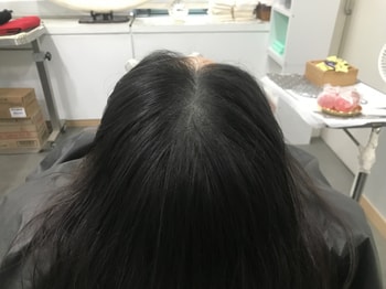 보강 후