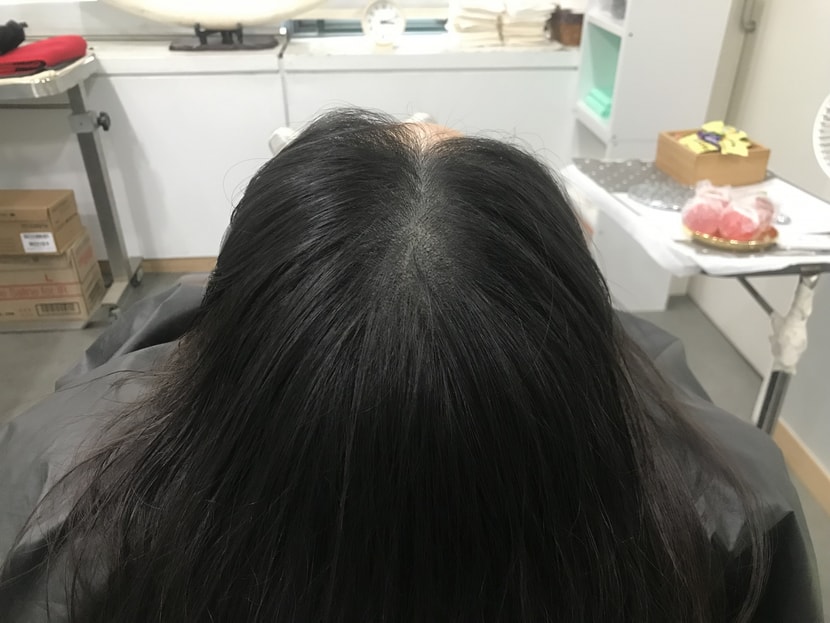 보강 후