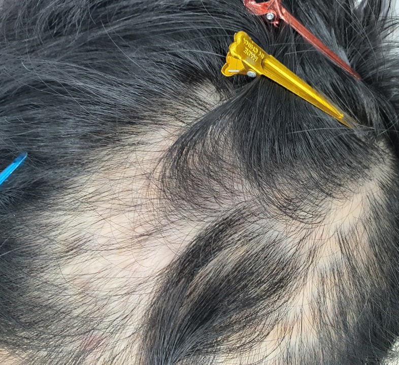 Post a review of your scalp tattoo in Busan!!