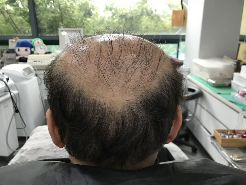 두피문신전 사진입니다~