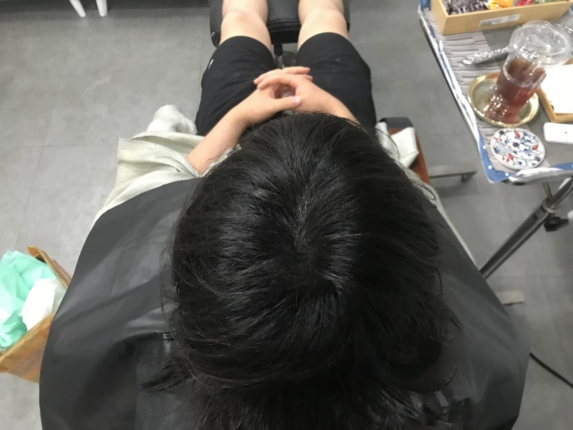  시술후