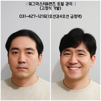 고정식 가발