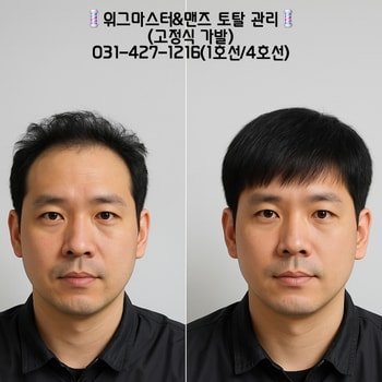 고정식 가발
