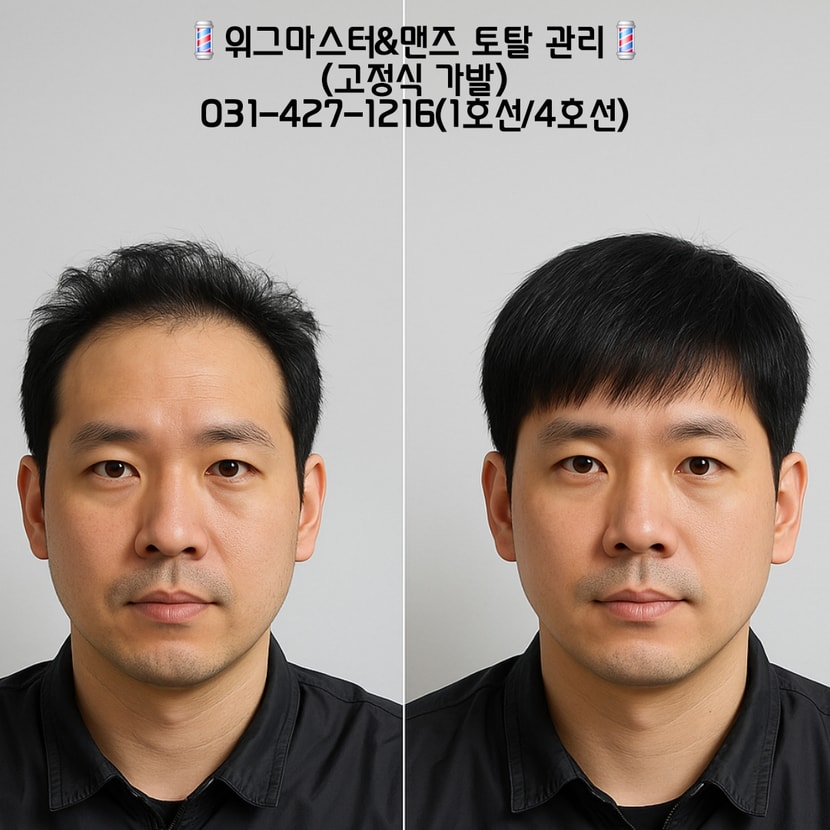 고정식 가발