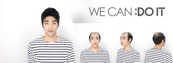 조대표의 가발착용 전/후 :D